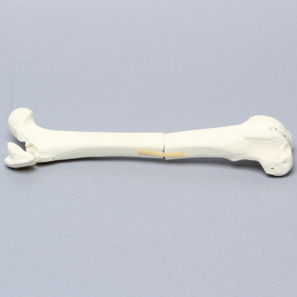 Canine Femur with Greater Trochanteric Fractures, Foam Cortical