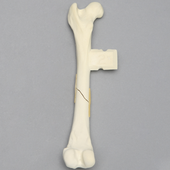 Canine Femur with Midshaft Short Oblique Fracture, Foam Cortical
