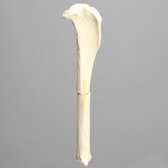 Canine Tibia with Transverse Fracture