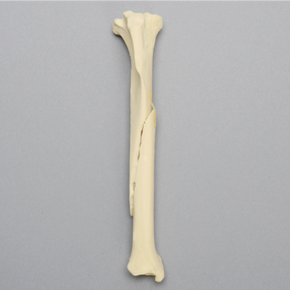 Canine Tibia with Long Oblique Midshaft Fracture, No Vise Attachment