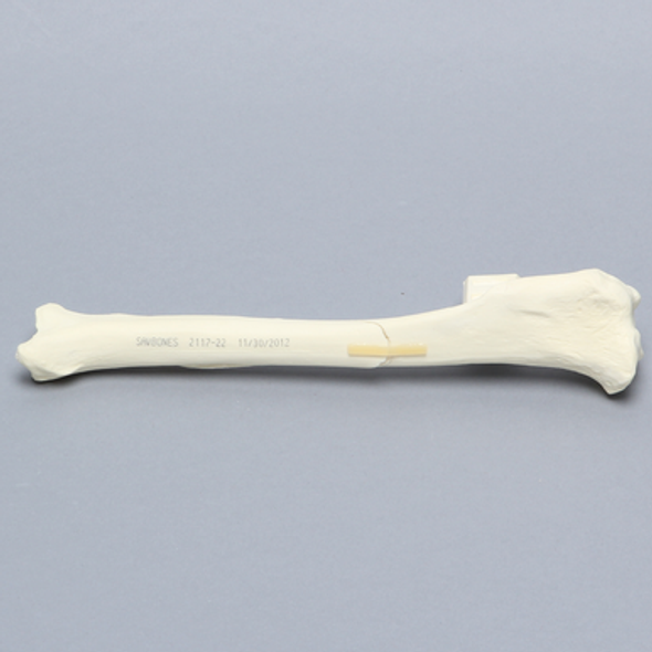 Canine Tibia with Long Oblique Midshaft Fracture, With Vise Attachment