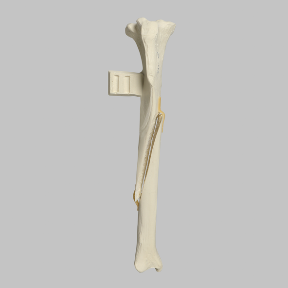Canine Tibia with Long Oblique Midshaft Fracture, With Vise Attachment