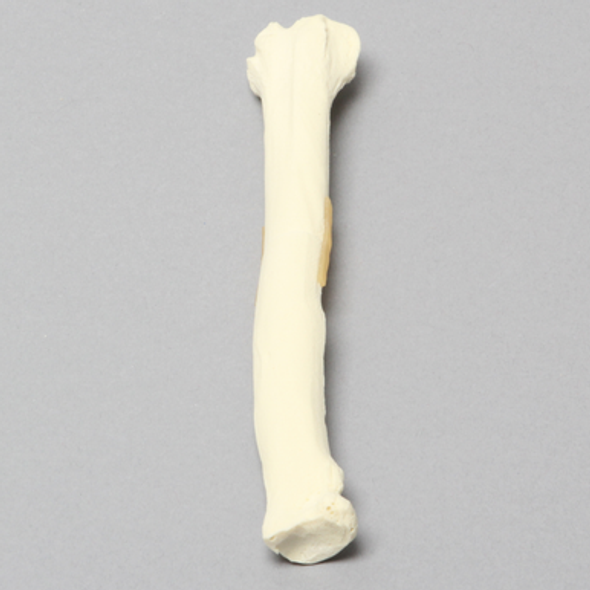 Canine Radius with Midshaft Transverse Fracture, Solid Foam, Right