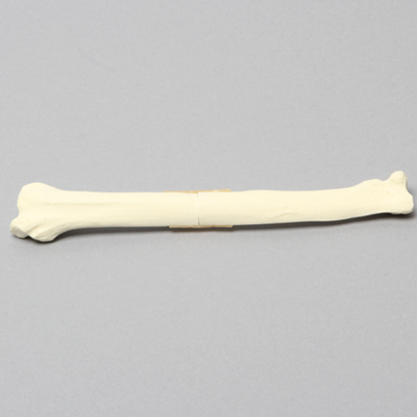 Canine Radius with Midshaft Transverse Fracture, Solid Foam, Right