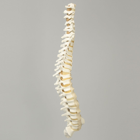 Spine, C1 to Sacrum with Pedicle Drilling and Reinforced Flex Rod, Full