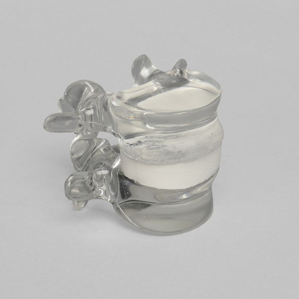 Lumbar Vertebrae L4 - L5 with White Foam Disc, Solid Clear Plastic