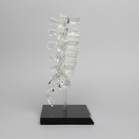 Spine with Clear Discs, Lumbar, Solid Clear Plastic