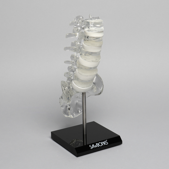 Spine with White Foam Discs, Lumbar, Solid Clear Plastic