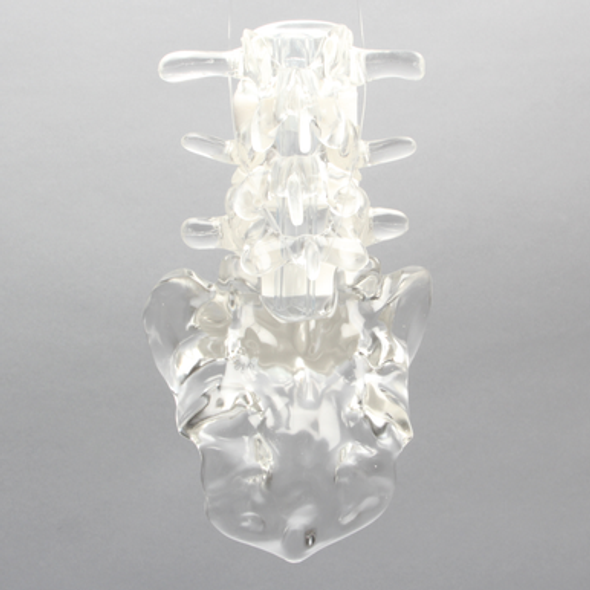 Lumbar Vertebrae L3-Sacrum with White Foam Discs, Solid Clear Plastic
