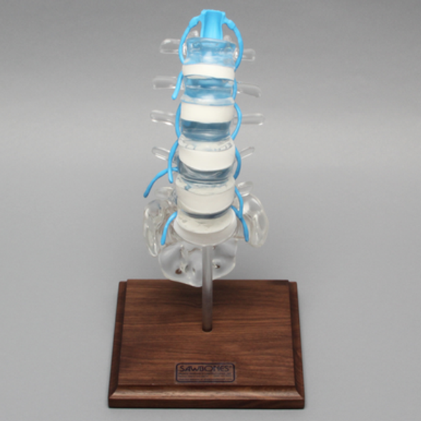 Spine with Nerve Roots, Lumbar, Solid Clear Plastic
