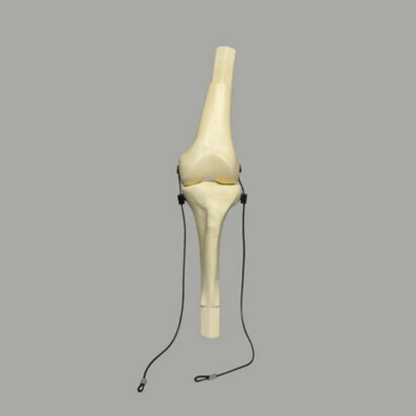 Converge™ Large Knee Joint with Adjustable Ligaments