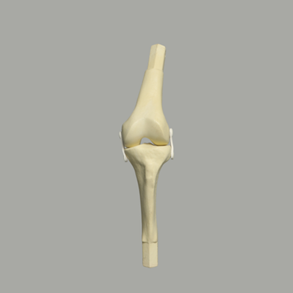 Converge™ Medium Knee Joint with Non-Stretch Ligaments