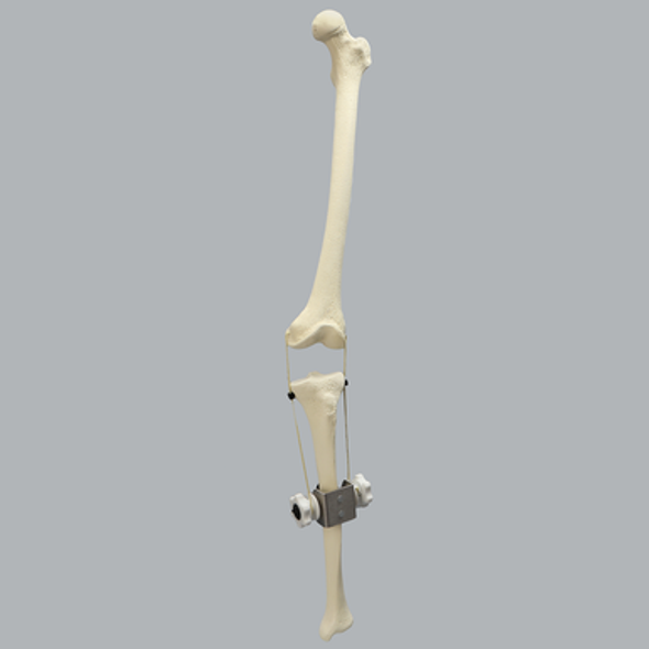 Ligament Balancer