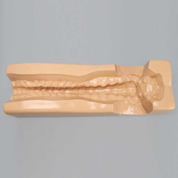 Spine Holder with Iliac Cutout