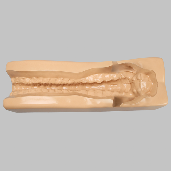 Spine Holder with Iliac Cutout