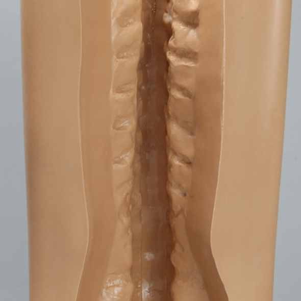 Spine Holder, Posterior T1-Sacrum