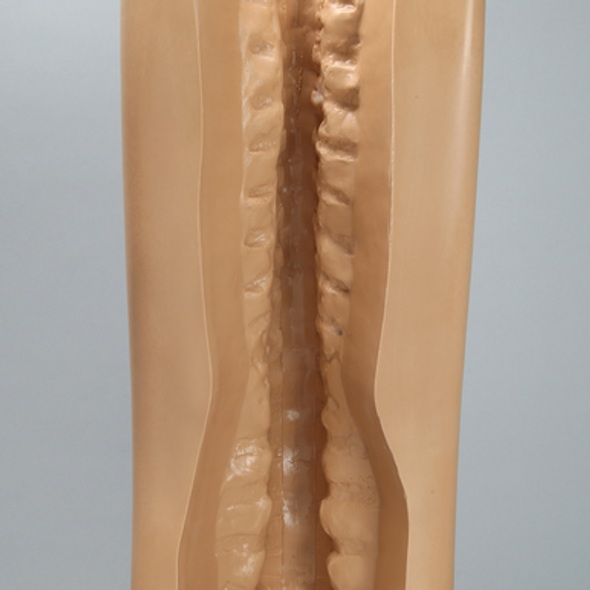 Spine Holder, Posterior C1-Sacrum
