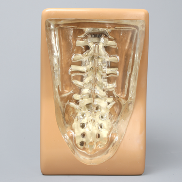 Spine Holder Set, L1-Sacrum