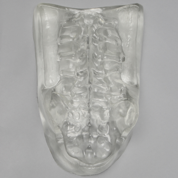 Clear Cover for Lumbar Holder #1524-1 Without Portals