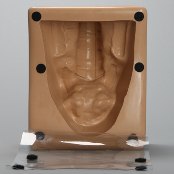 Spine Holder, Posterior L3-Sacrum