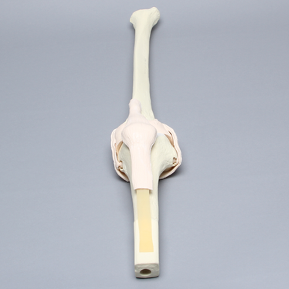 Knee Insert, Arthroscopy