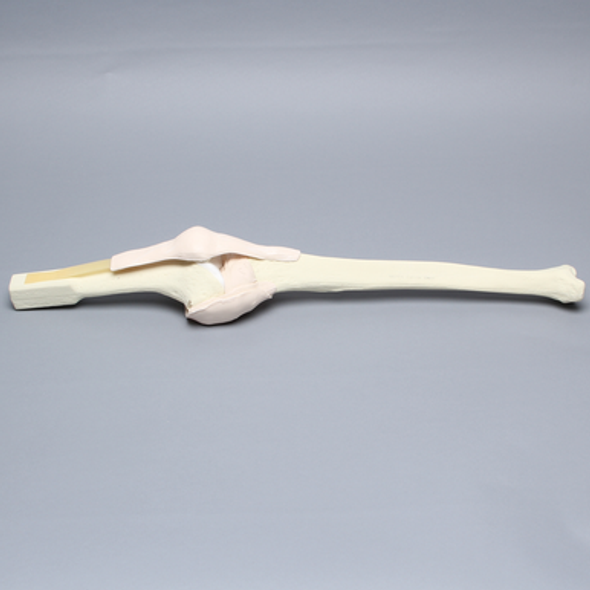 Knee Insert, Arthroscopy