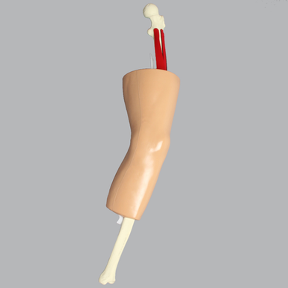 Knee, M.I.S.