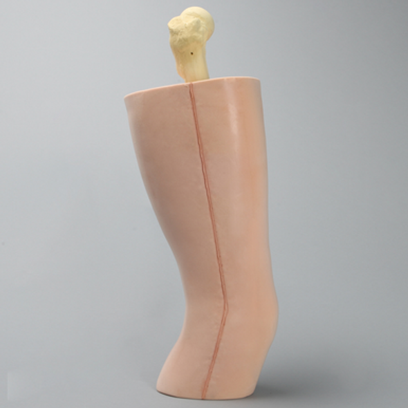 Femur, Encased in Soft Tissue
