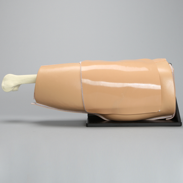 Arthroscopy Hip, on Basic Stand