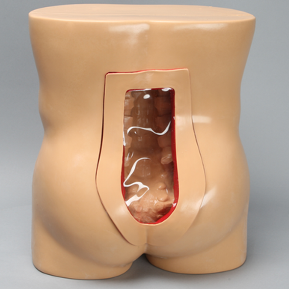 Vertebroplasty Trunk, Short