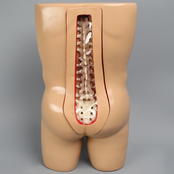 Vertebroplasty Trunk with Spine Model