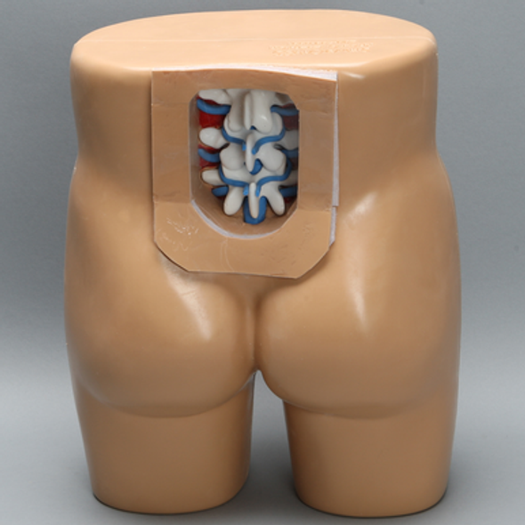 Lumbar Vertebrae Soft Tissue Trunk with Window