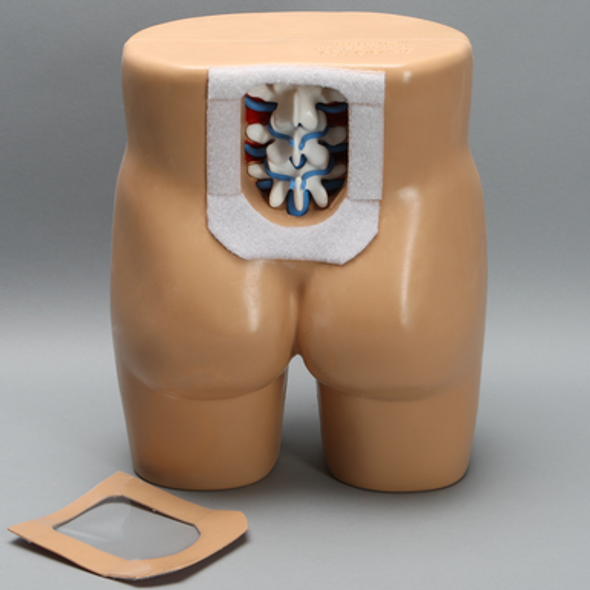 Lumbar Vertebrae Soft Tissue Trunk with Window
