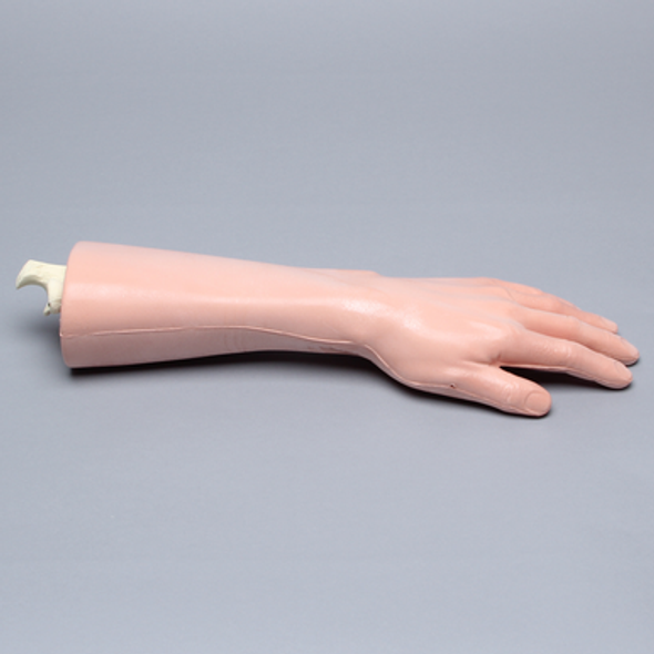 Wrist with Four-Part Fracture, Artery, Nerve, and Tendons, Encased