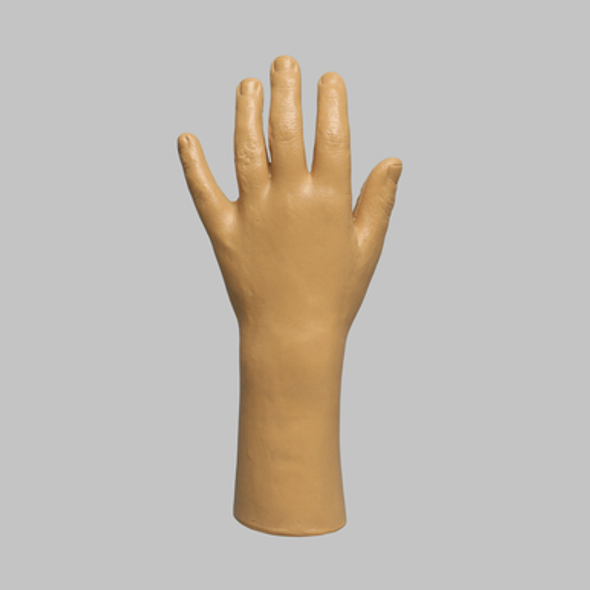 Wrist, Pediatric, Encased