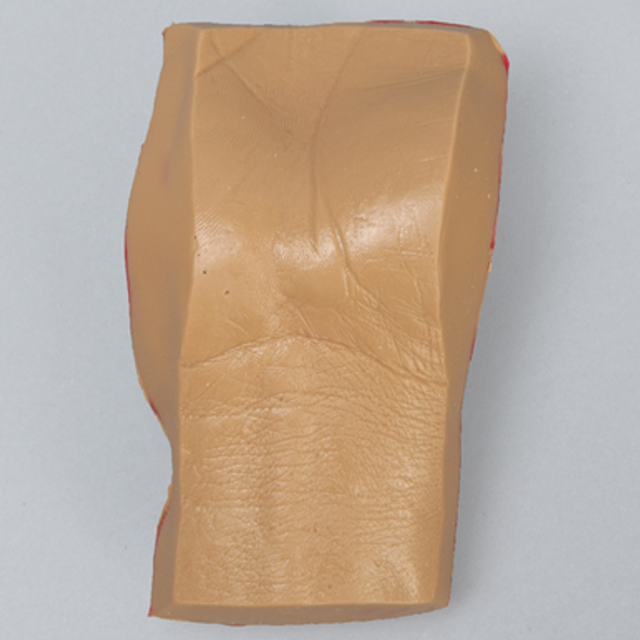 Palmar Insert
