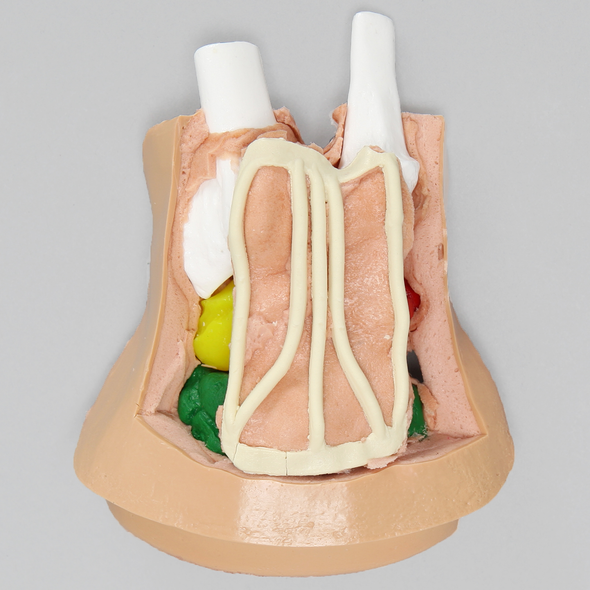 Arthroscopy Wrist Insert, Replacement