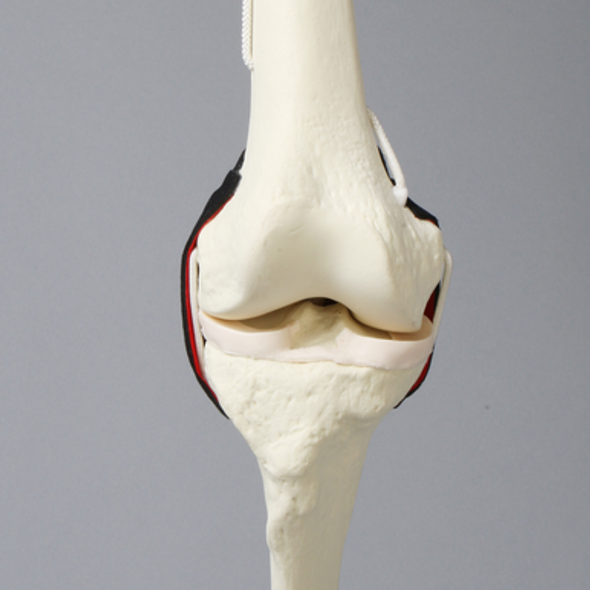 Knee Insert, Encapsulated ACL with Adjustable Ligament