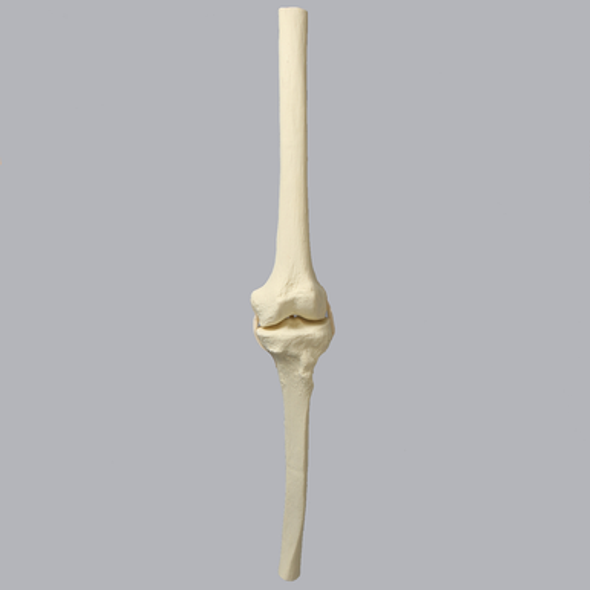 Knee Insert, ACL, Solid Foam