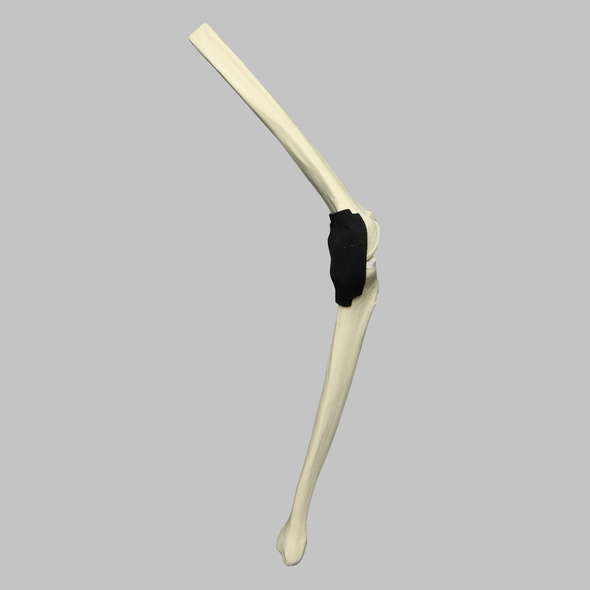 Knee Insert, Encapsulated ACL, Medium Knee Insert, Encapsulated ACL, Medium