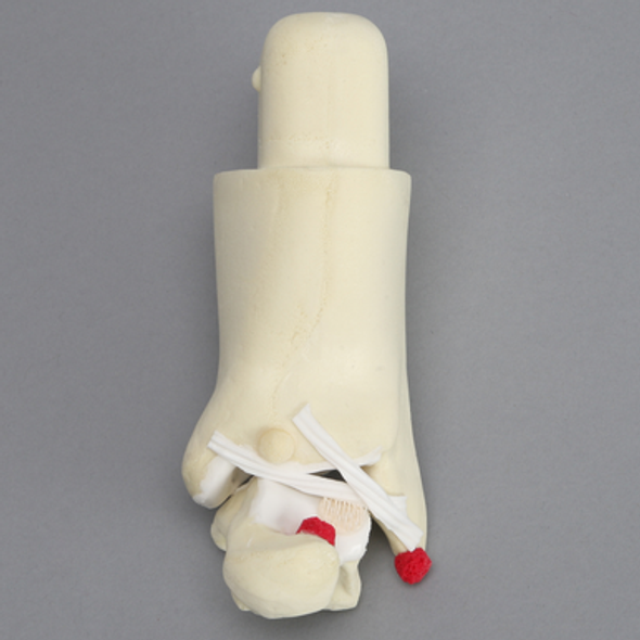 Arthroscopy Foot and Ankle Trainer Insert, Advanced Version 1