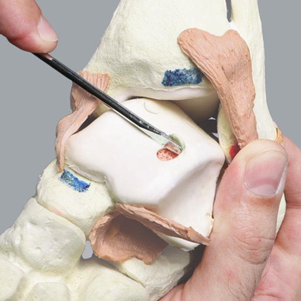 Able Advanced Arthroscopy Ankle