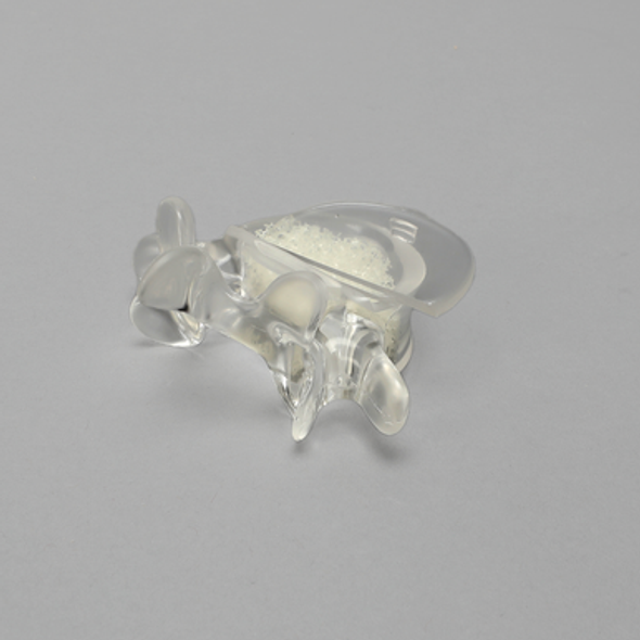 Vertebra, L5, With Replaceable Insert, 4.5mm Pedicle Entry Sites, Transparent Cortical