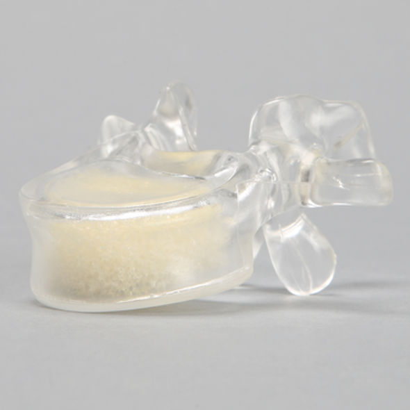 Vertebra L1 with Open Cell Cancellous, Solid Clear Plastic