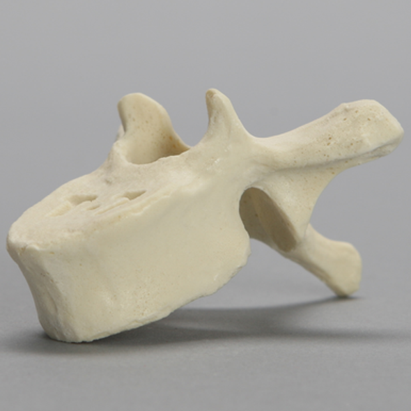 Vertebra, T7, Foam Cortical