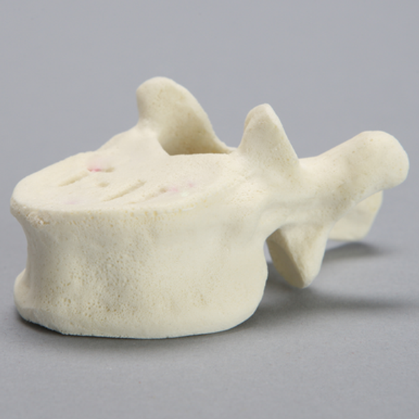 Vertebra, T11, Foam Cortical