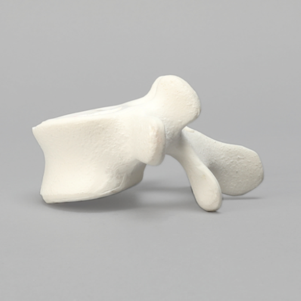 Vertebra, L5, Foam Cortical Shell, For Spinal Navigation
