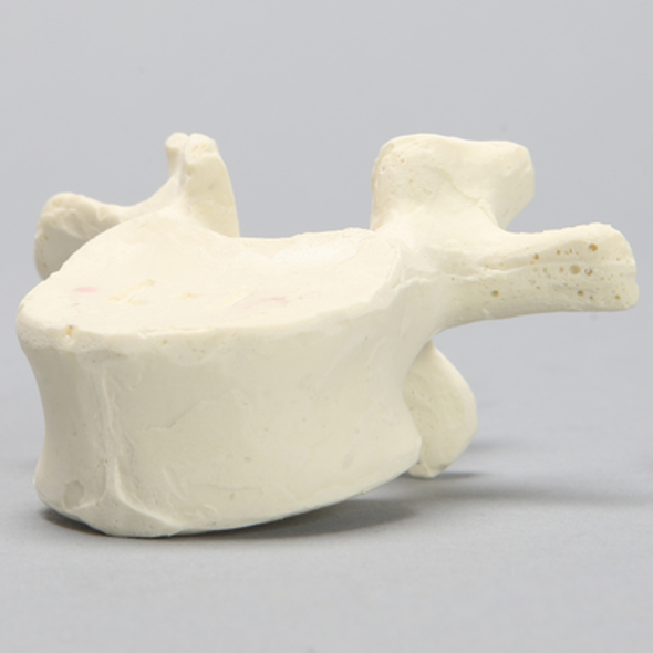 Vertebra, L1, Foam Cortical
