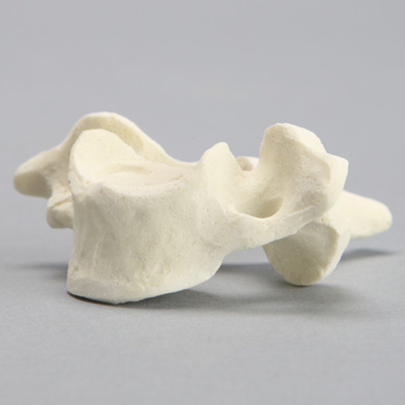 Vertebra, C7, Solid Foam