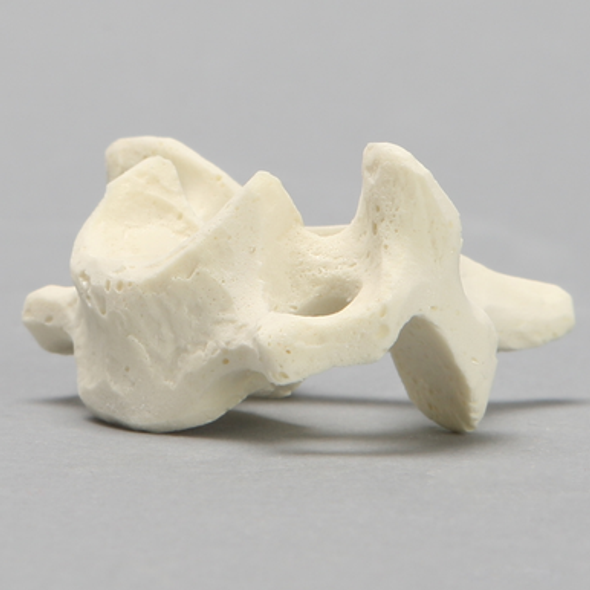 Vertebra, C6, Solid Foam